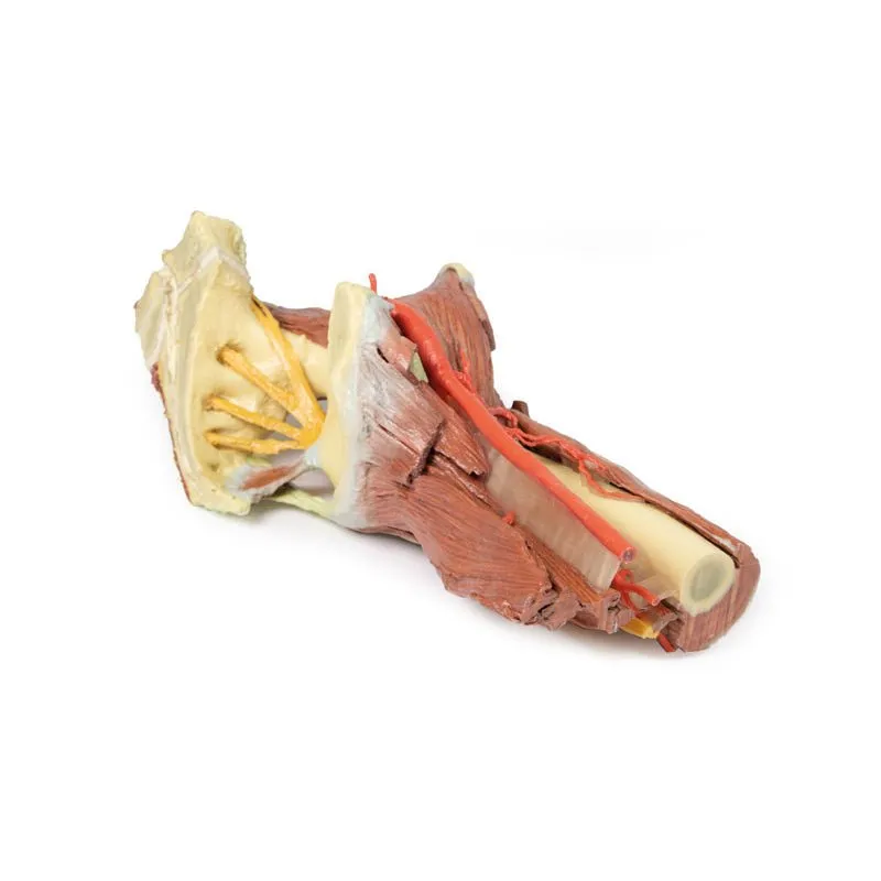 3D Printed Lower Limb - deep dissection of a left pelvis and thigh
